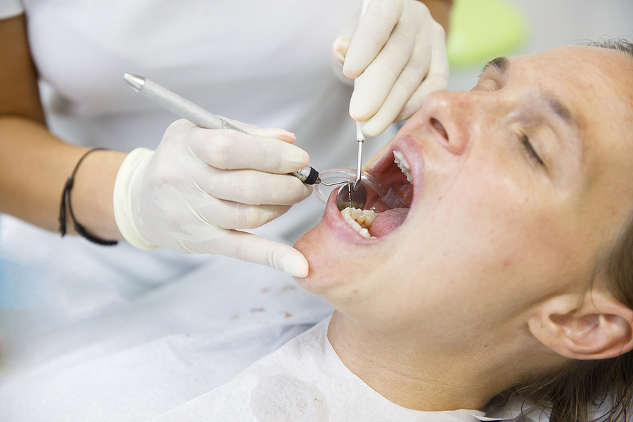 Patient getting her gum pocket depth measured with periodontal probe held by dental hygienist examining progression of periodontal disease. Dental hygiene periodontal disease prevention concept.