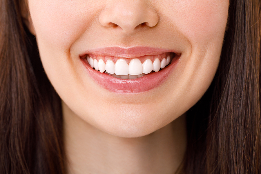 A Beautiful Woman Is Smiling. A Smile With White Teeth. Close Up Cosmetic Dentistry
