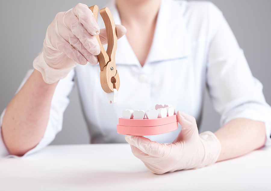 Dentist Pulling Tooth With Forceps Out Of Jaw Model. Wisdom Teet