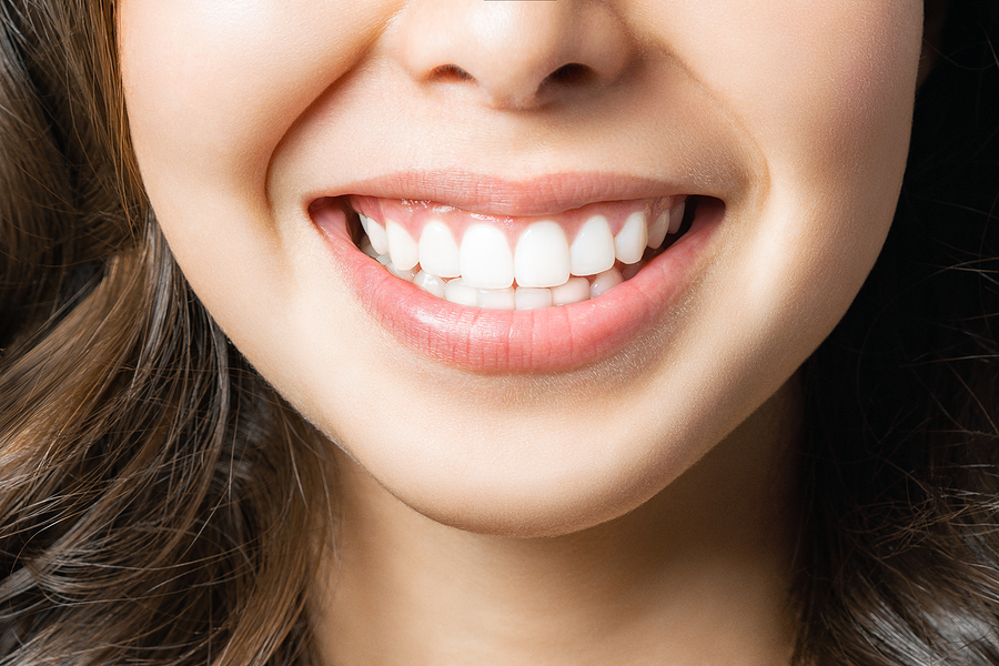 Perfect Healthy Teeth Smile Of A Young Woman. Teeth Whitening. D