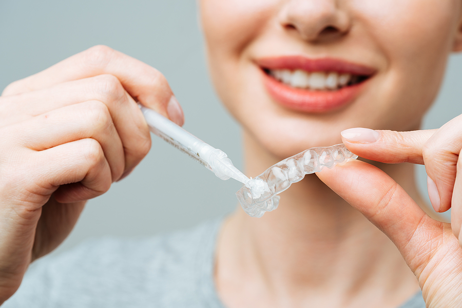 A Young Woman Does A Home Teeth Whitening Procedure. Whitening T