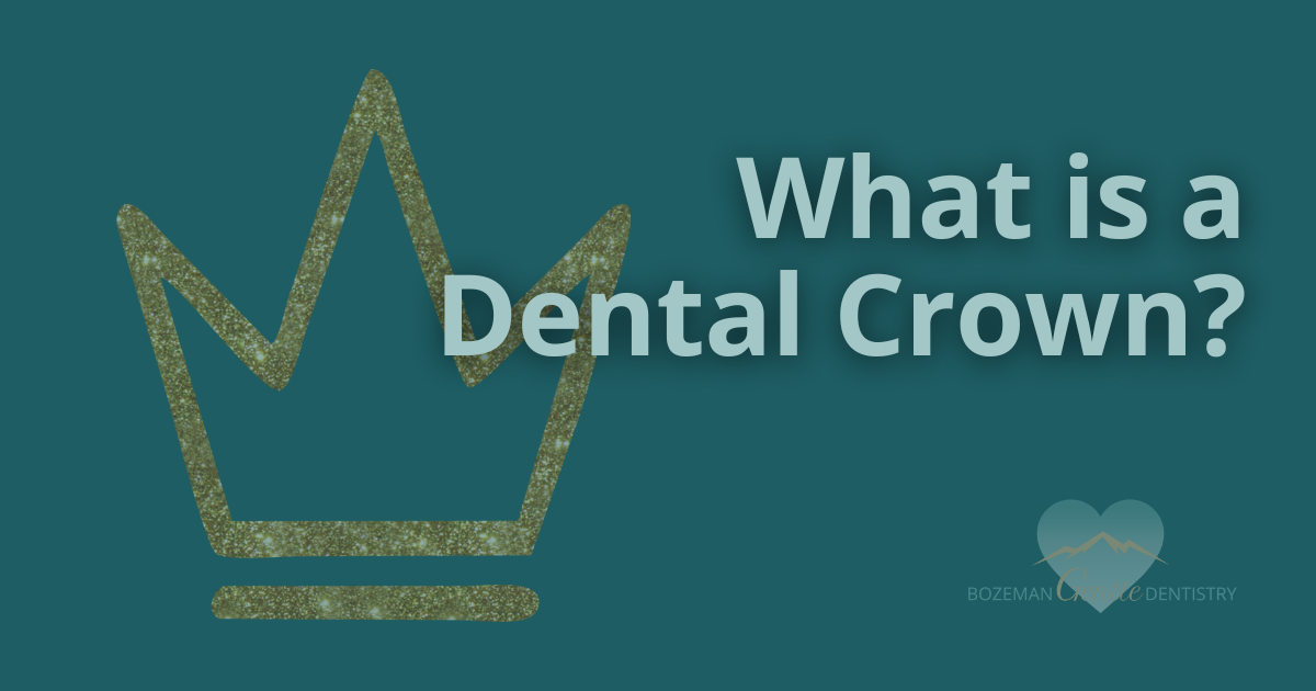 What Is a Dental Crown?