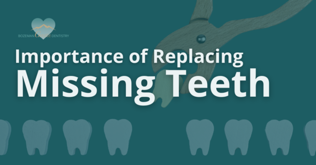 Murphy Blog June 23 Importance of Replacing Missing Teeth