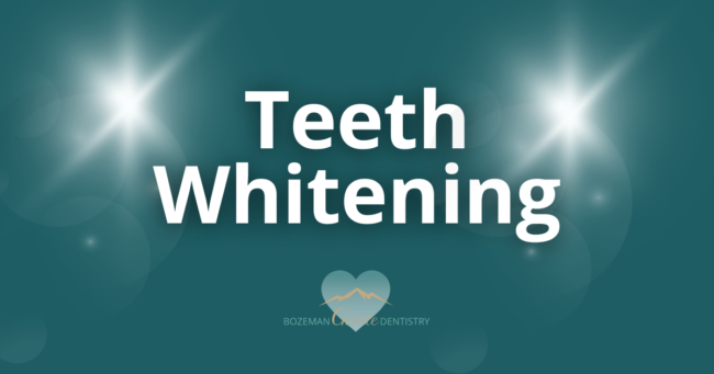 Murphy Email July 23 Teeth Whitening at Bozeman Gentle Dentistry