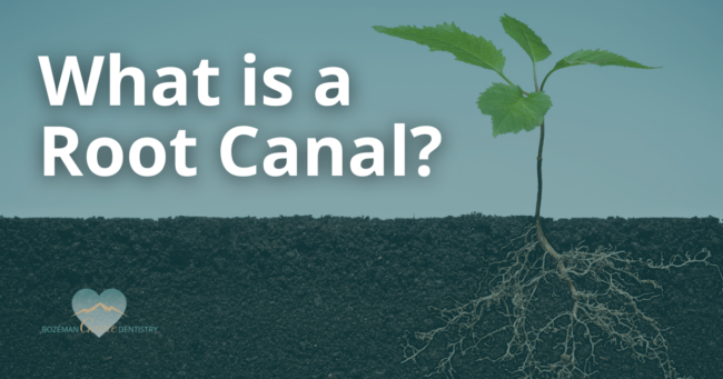 Murphy Blog August 23 What Is a Root Canal?