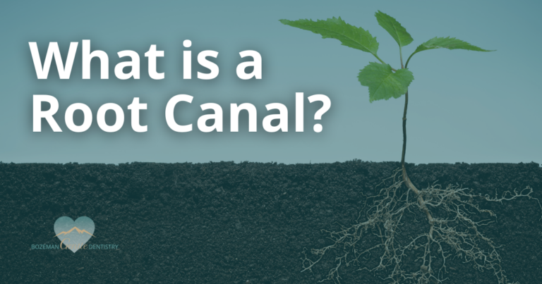 What Is a Root Canal?