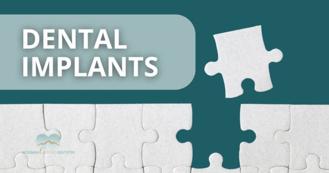 Murphy Sept 23 Blog Dental Implants at Bozeman Gentle Dentistry
