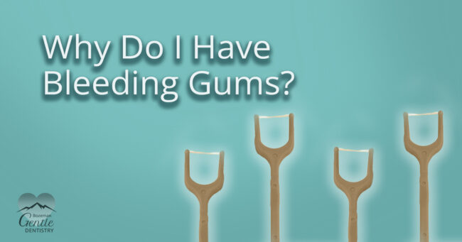 Why Do I Have Bleeding Gums?